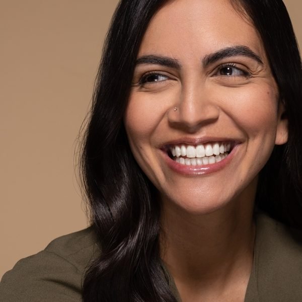 sonrisa-dientes-perfectos